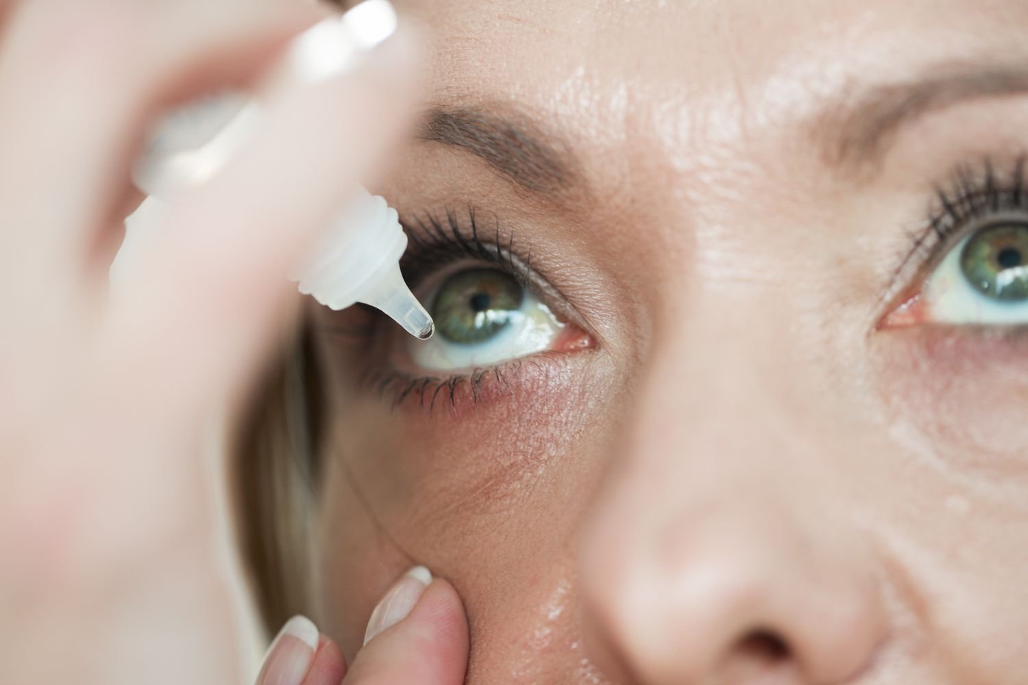 dry skin around eyes